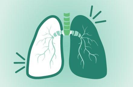 COPD KOVAG 1.jpg